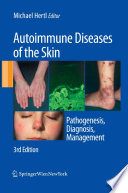 Autoimmune Diseases of the Skin Pathogenesis, Diagnosis, Management