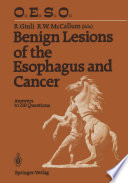 Benign Lesions of the Esophagus and Cancer Answers to 210 Questions