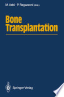 Bone Transplantation