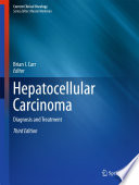 Hepatocellular Carcinoma Diagnosis and Treatment