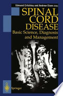 Spinal Cord Disease Basic Science, Diagnosis and Management