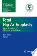 Total Hip Arthroplasty Wear Behaviour of Different Articulations
