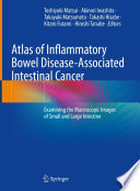 Atlas of inflammatory bowel disease-associated intestinal cancer : examining the macroscopic images of small and large intestine