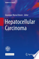 Hepatocellular carcinoma