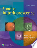 Fundus autofluorescence