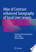 Atlas of contrast-enhanced sonography of focal liver lesions