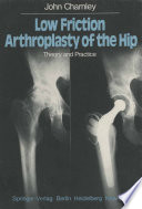 Low Friction Arthroplasty of the Hip Theory and Practice