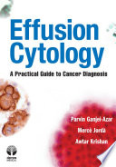 Effusion cytology : a practical guide to cancer diagnosis