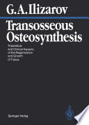 Transosseous Osteosynthesis Theoretical and Clinical Aspects of the Regeneration and Growth of Tissue