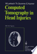 Computed Tomography in Head Injuries