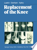 Replacement of the Knee