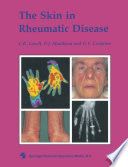 The Skin in Rheumatic Disease