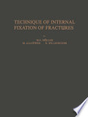 Technique of Internal Fixation of Fractures