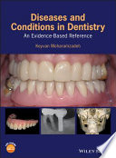 Diseases and conditions in dentistry : an evidence-based reference