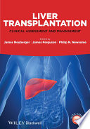 Liver Transplantation : Clinical Assessment and Management.