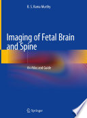 Imaging of Fetal Brain and Spine An Atlas and Guide