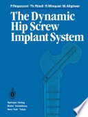 The Dynamic Hip Screw Implant System
