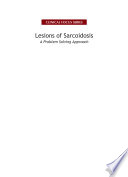 Lesions of sarcoidosis : a problem solving approach