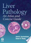 Liver pathology : an atlas and concise guide