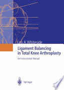 Ligament Balancing in Total Knee Arthroplasty An Instructional Manual